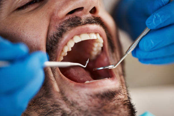 Best Teeth Whitening  in Delshire, OH